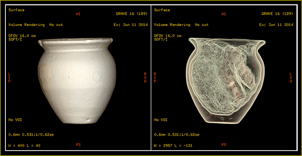 Rhodaus Town Ceramics CT scans  Images: Canterbury Archaeological Trust 