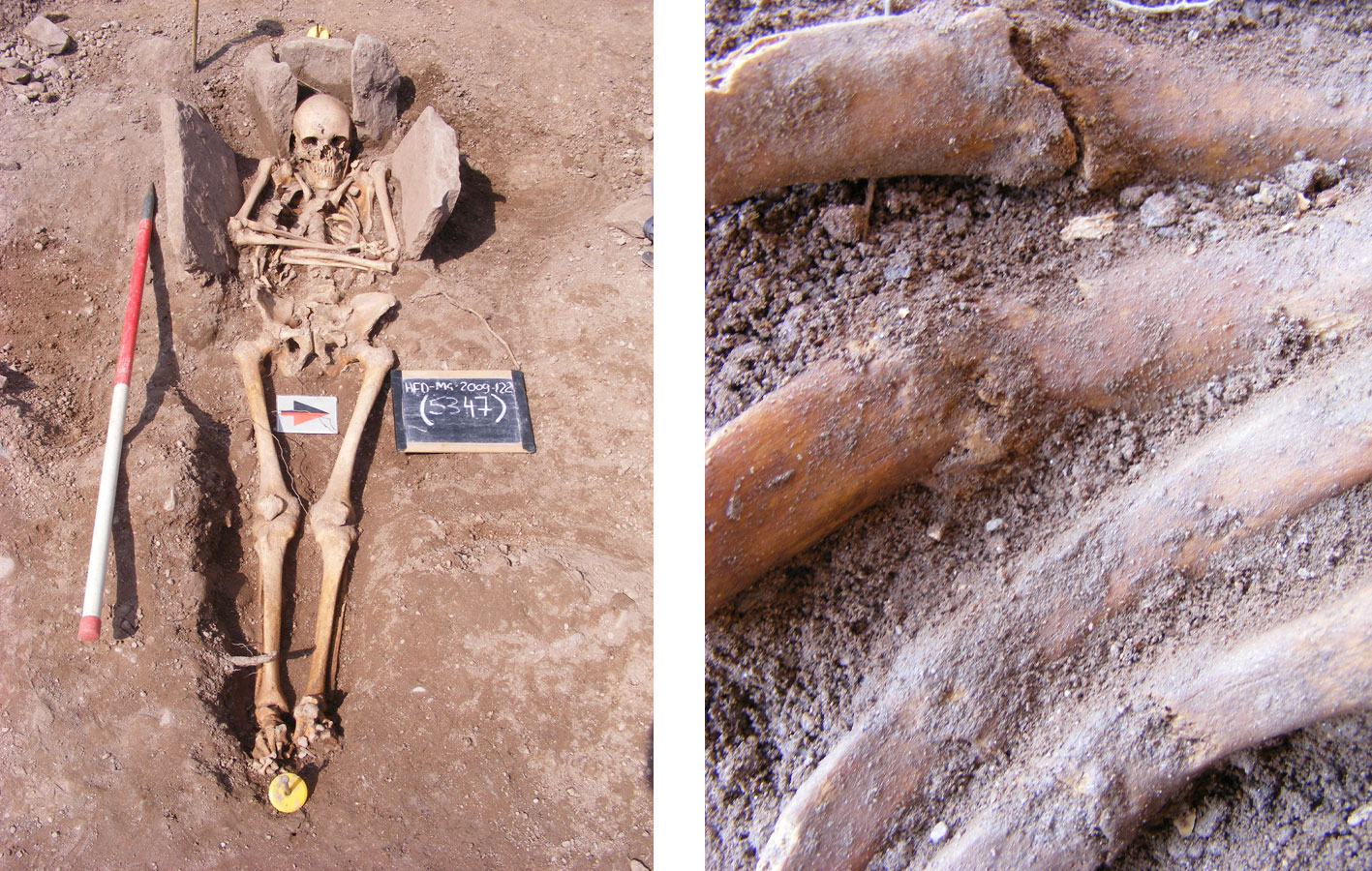 The possible knight with his fracured and unhealed ribs. Image: Headland Archaeology Limited