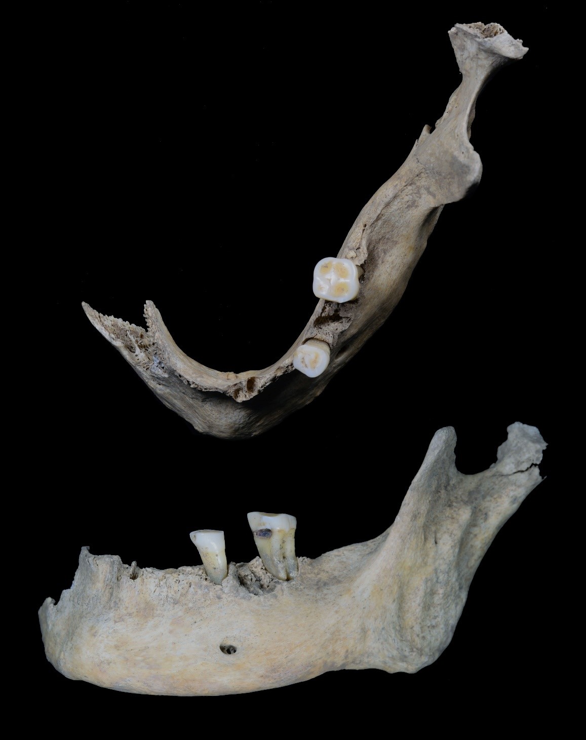 Human Jaw Unearthed at The Cairns. Copyright: University of the Highlands and Islands Archaeology Institute