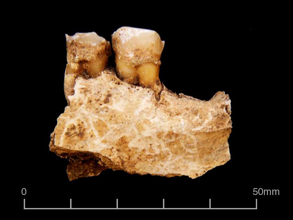 Teeth in mandible, ready for sampling