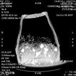 large inverted bucket CT scan. Image: Oxford Archaeology