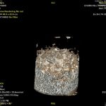 Urn Contents CT scan. Image: Oxford Archaeology